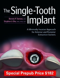 The Single-Tooth Implant